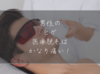 男性の髭の医療脱毛はかなり痛い